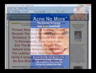 Acne No More Review - Product WalkThrough of Acne No More