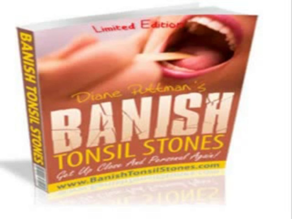 Banish Tonsil Stones Book Review | Banish Tonsil Stones Guide