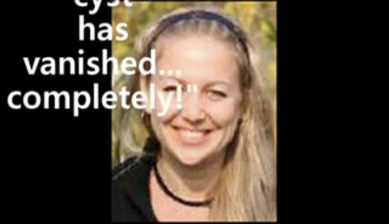 Dermoid Ovarian Cyst Ovarian Cyst Miracle- Bonuses $365.87!