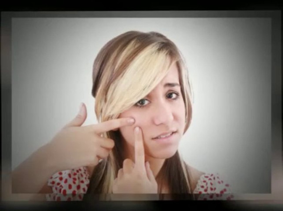 Acne No More - Cure Acne Holistically
