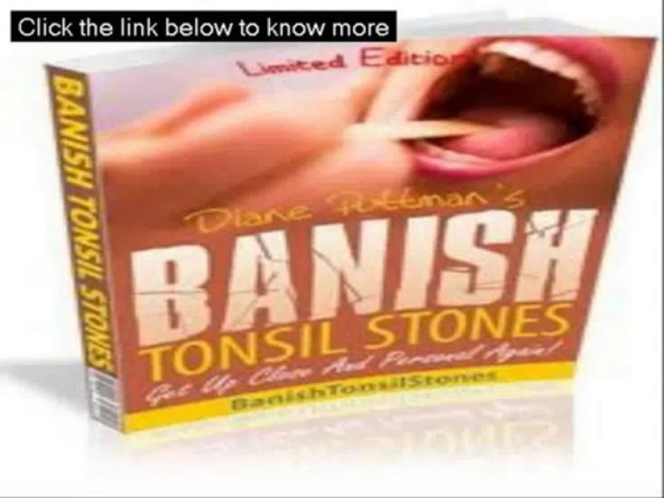 Banish Tonsil Stones Book Review - Banish Tonsil Stones Review