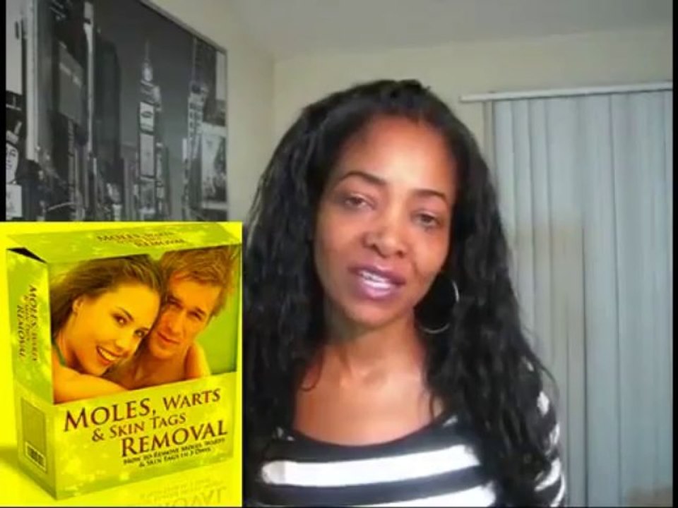 2013:Moles Warts Skin Tags Removal Review