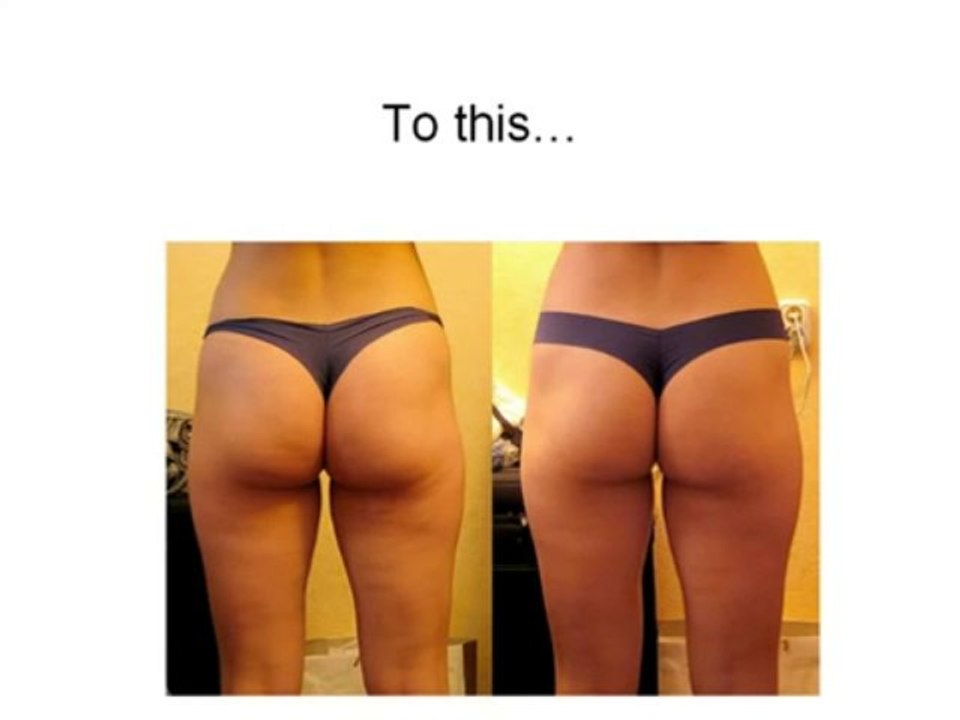 Cellulite Factor- Free presentation