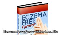Eczema Free Forever Review - Is Eczema Free Forever Scam Or Legit?