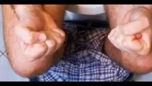 Hemorrhoid No More | Hemorrhoid No More Review