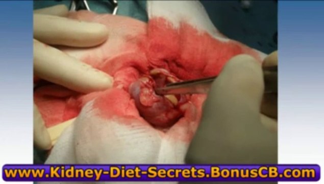 Kidney Diet Secrets REVIEW Rachelle Gordon