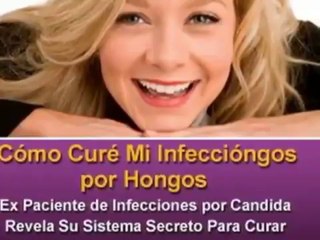 Infecciones Por Hongos No Mas Linda Allen