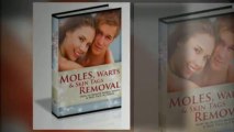 Moles Warts Skin Tags Removal - Review of Charles Davidson Moles Warts Skin Tags Removal System