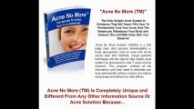 Acne No More - Cure Acne Holistically