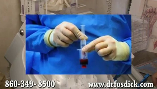 Treatment for Plantar Fasciitis - Podiatrist in Middlefield, CT