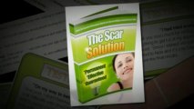 The Scar Solution Review - Get Rid of your Scars Now!