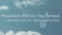 MolesWarts And Skin Tags Removal REVIEW-Easily, Naturally And Without Surgery
