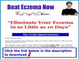 Beat Eczema Susan Clark   Beat Eczema Guide