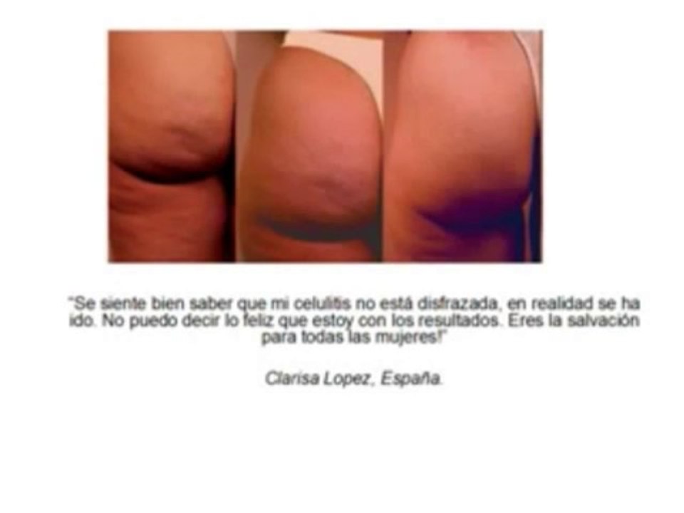 Ejercicios Celulitis Nunca Mas / Celulitis Nunca Mas / Ejercicios Celulitis Nunca Mas Descargar