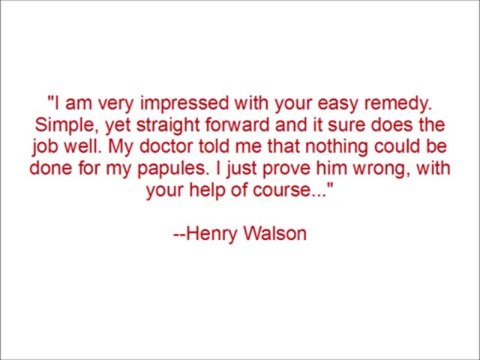 Pearly Penile Papules Removal Review-Does The Pearly Penile Papules Program Work?