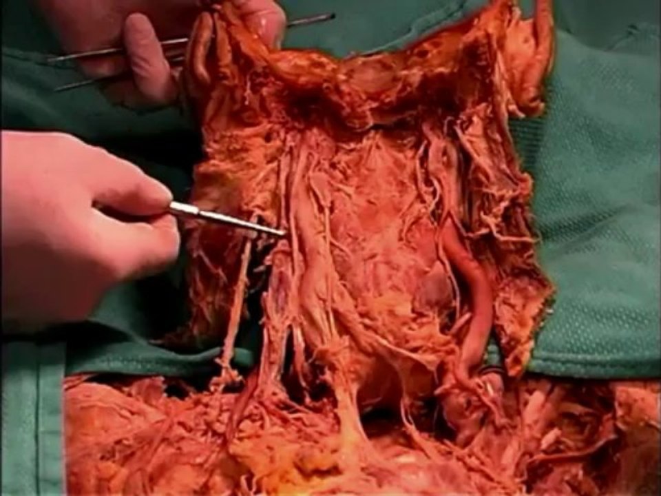 Human Anatomy Dissection 18 (part 2 of 3) Pharynx