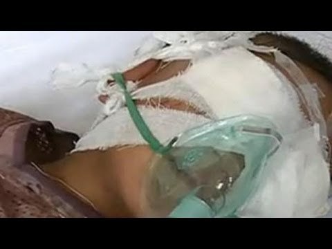 Organ trafficking: 6-year-old's eyes stolen by organ traffickers in China