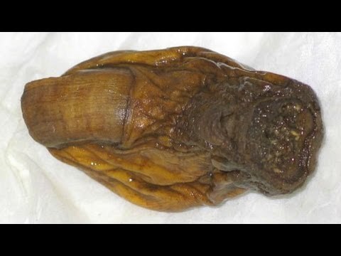 Man swallows toe, pays $500 fine at Downtown Hotel in Yukon