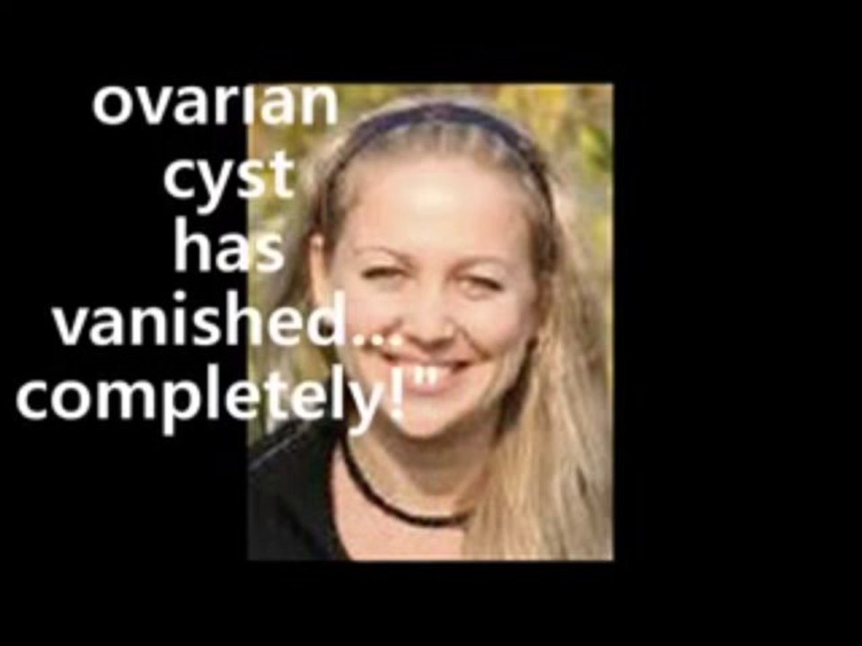 Polycystic Ovary Syndrome Pcos Ovarian Cyst Miracle- Bonus $365.87!