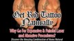 Get Rid Tattoo - Natural Tattoo Removal Solution 4 Home