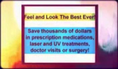 White Patches On Skin - Natural Vitiligo Treatment system