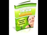 The Scar Solution Review | How To Get Rid Of Scars On Legs | How To Get Rid Of Stretch Marks