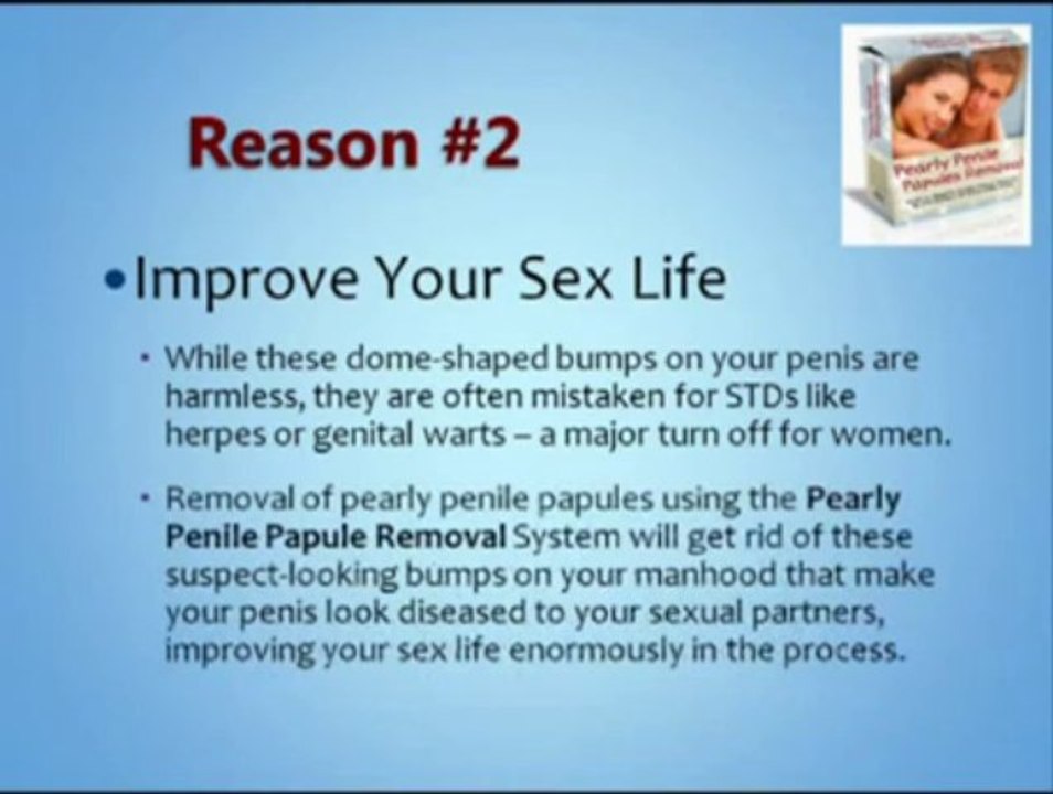 Natural Pearly Penile Papules Removal