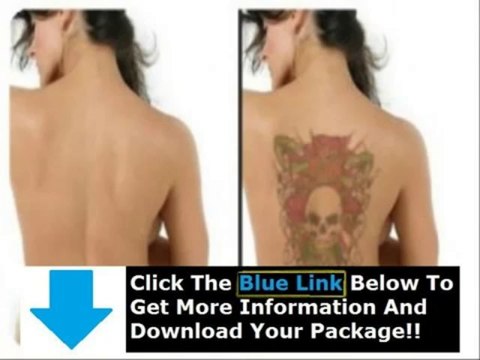 Get Rid Tattoo Free Download + Get Rid Tattoo Naturally Book