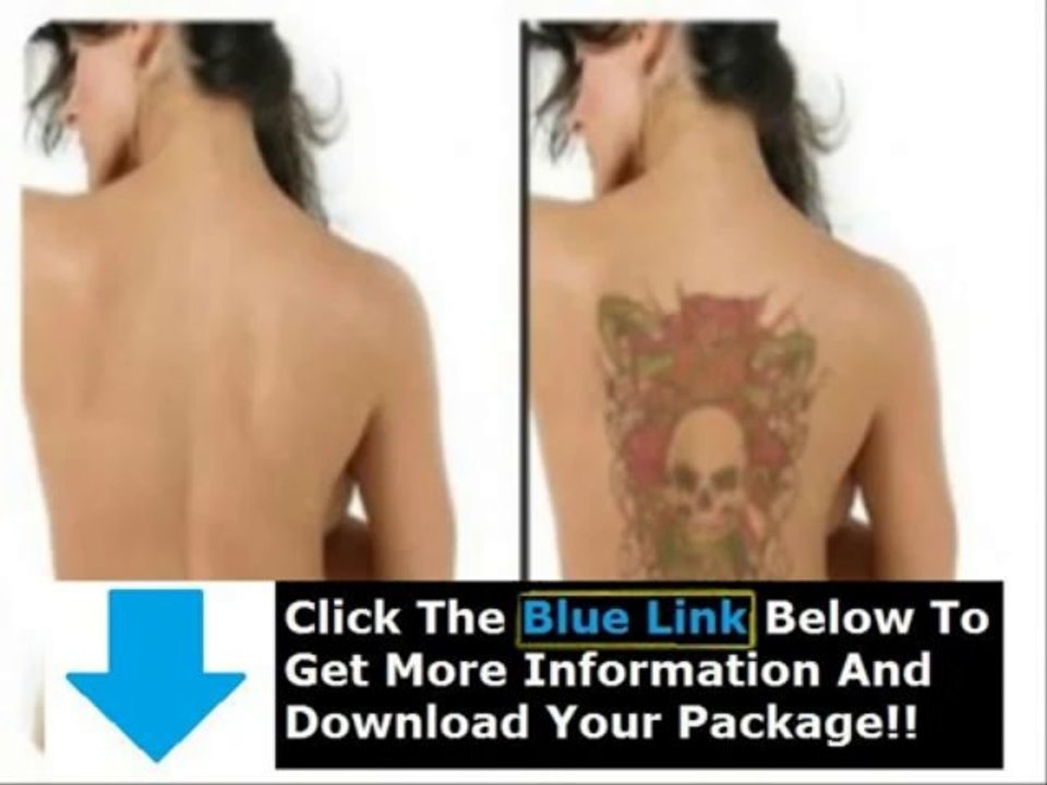 Get Rid Tattoo Free Download + Get Rid Tattoo Naturally Book