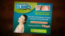 Banish My Bumps Review | Banish My Bumps PDF