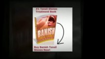 Banish Tonsil Stones - How To Remove Tonsil Stones