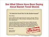 Banish Tonsil Stones | Banish Tonsil Stones Review