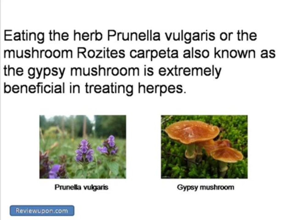 Treatment For Herpes - Get Rid Of Herpes Naturally