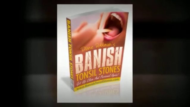 Banish Tonsil Stones | Banish Tonsil Stones PDF