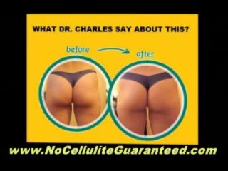 The Truth About Cellulite and What YOU Can Do To Concour it-Lose That &#39;Orange-Peel&#39; Look Today!