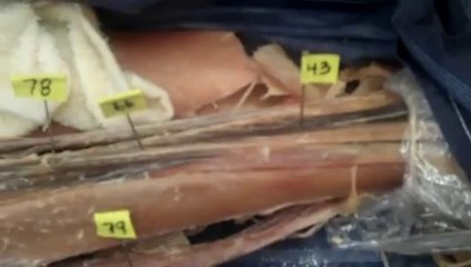 Human Anatomy, Walsh University, Dr. Diekens&#39; Lab