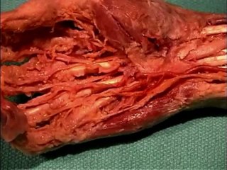 Human Anatomy Dissection 23 (part 1 of 2) Forearm and Hand