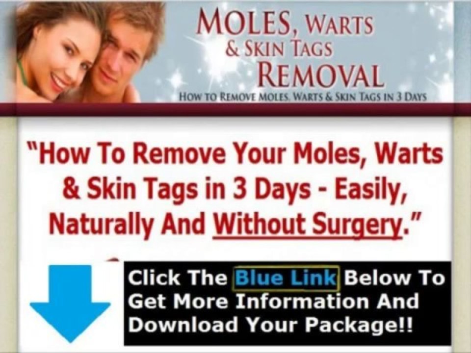 Moles Warts Removal Review + Moles Warts & Skin Tags Removal Pdf