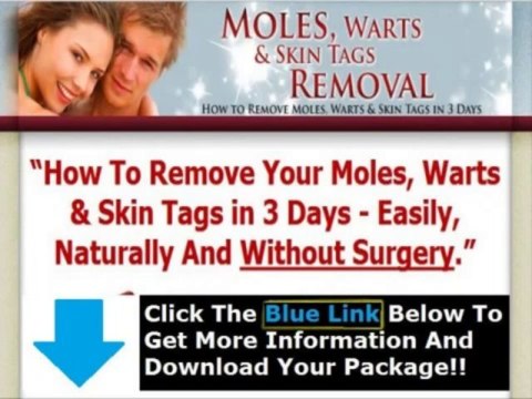 Moles Warts Removal Review + Moles Warts & Skin Tags Removal Pdf