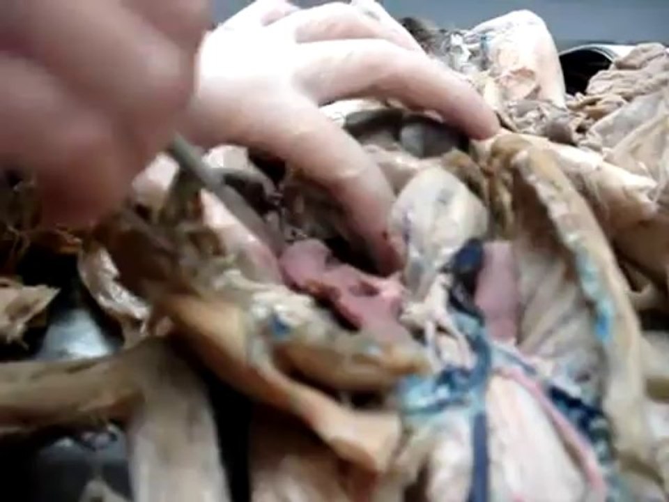 Human Anatomy Practical 3