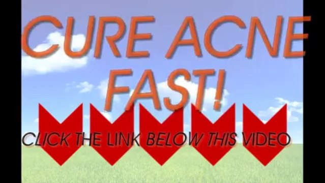 Buy Acne No More Natural Home Remedies For Acne Scars REVIEWS