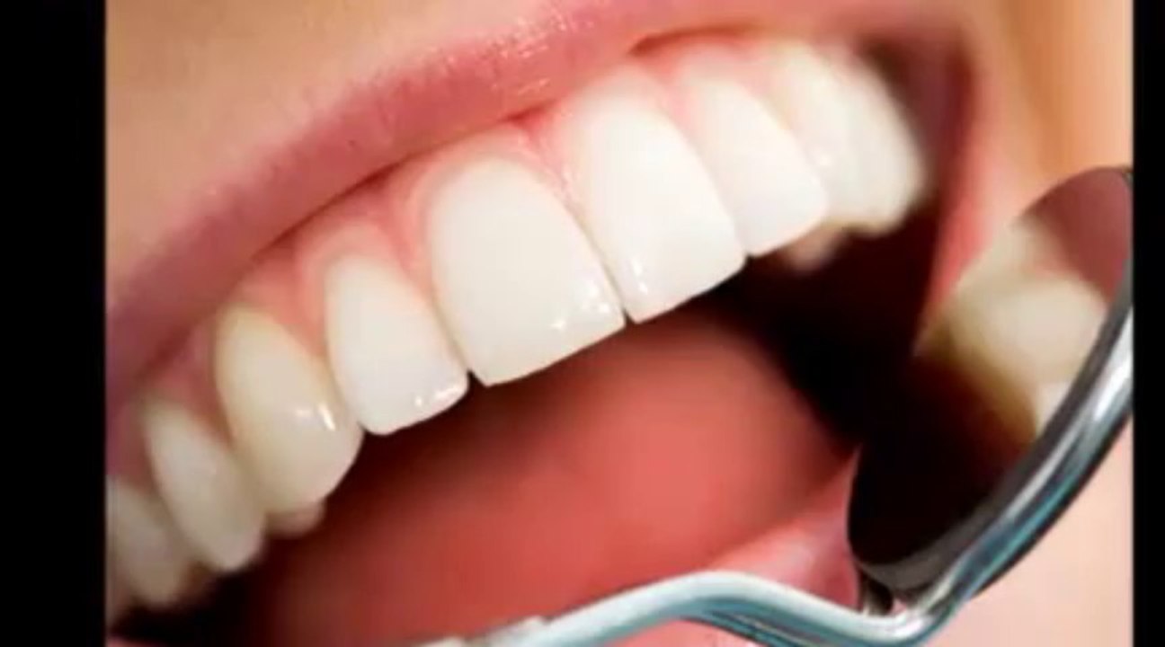 veneers jacksonville
