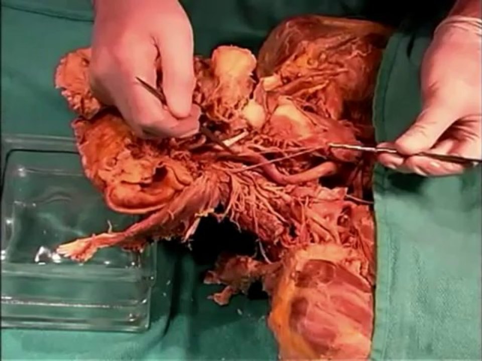 Human Anatomy Dissection 18 (part 1 of 3) Pharynx