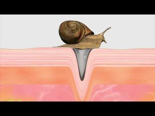 Snail Mucus: Cosmetic Industry's latest fad?