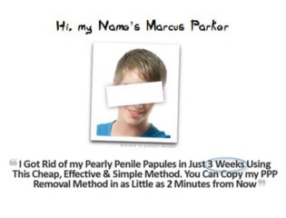 Natural and effective pearly penile papules removal