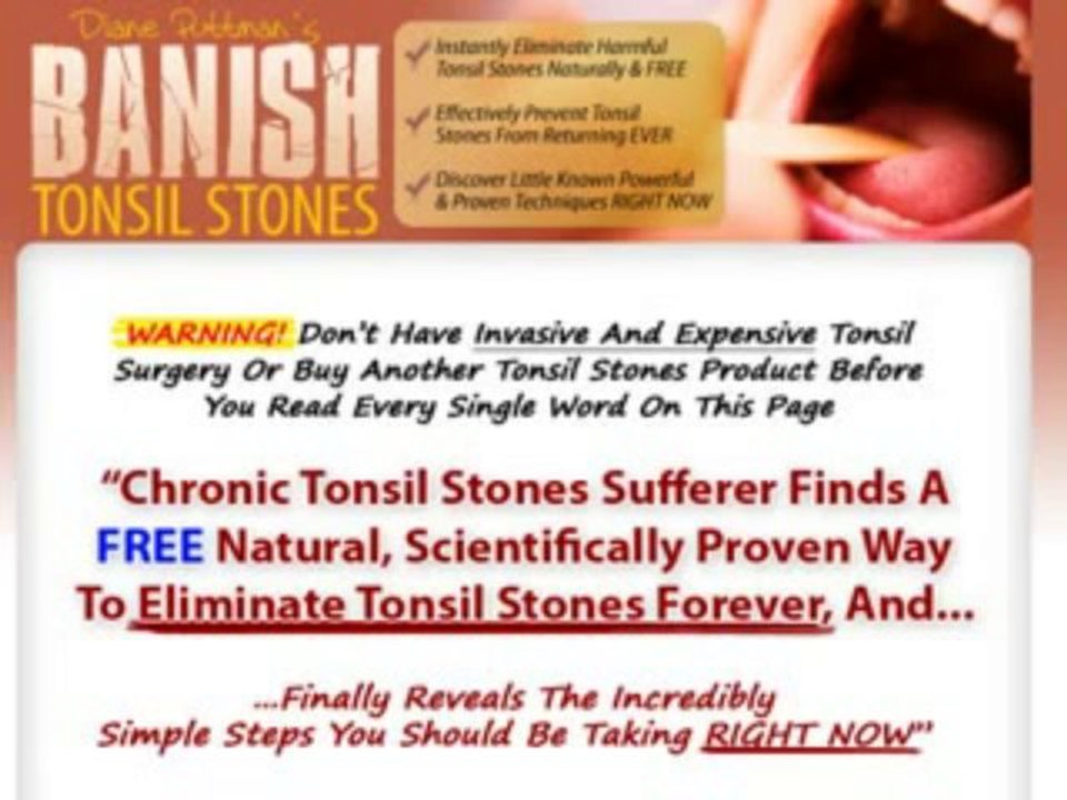 Reviews On Banish Tonsil Stones | Does Banish Tonsil Stones Really Work?