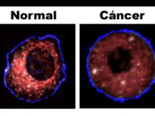 La Cura en un minuto | Cancer | Video Review