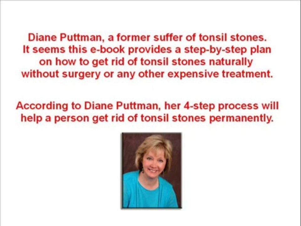Banish Tonsil Stones | Diane Puttman Banish Tonsil Stones