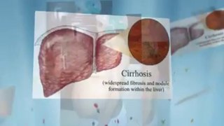 Liver Cirrhosis Bible