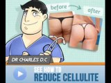 How to Get rid of Cellulite on Back of Thighs - Cellulite Factor Review